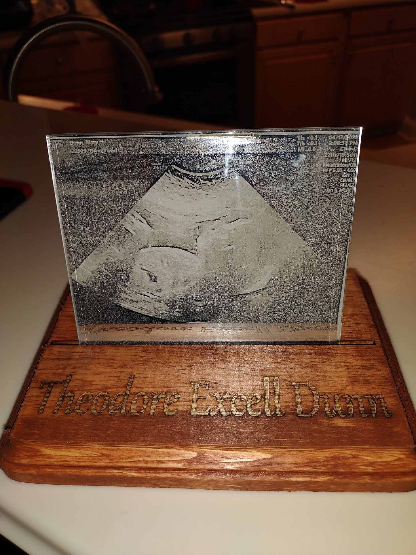 4x5 Etched Mirror Sonogram Photo